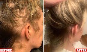 مکمل و قرص فیتو