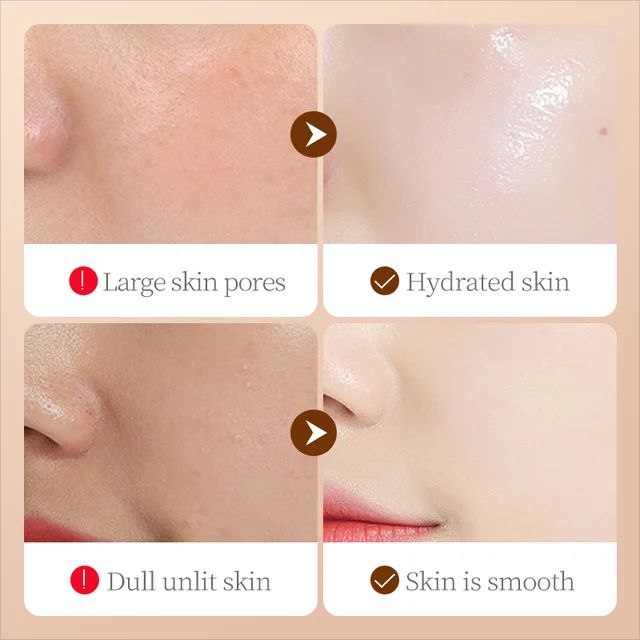 کرم کاسه ای صورت شیر بز سادور