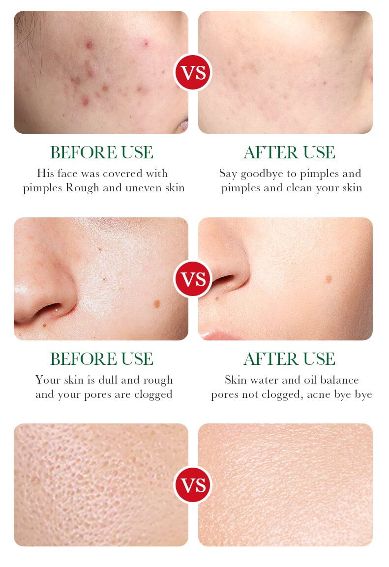 سرم سالسیلیک اسید بیواکوا