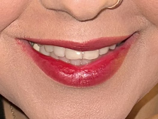 پک تخفیفی محصولات ارگانیک کوالا