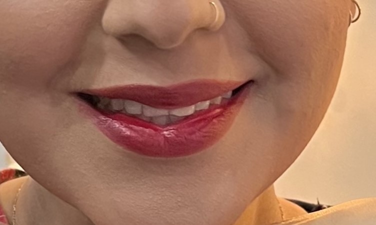 پک تخفیفی محصولات ارگانیک کوالا