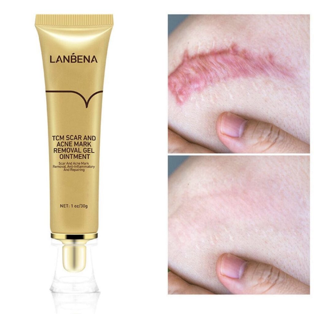 ژل کرم ترمیم کننده اسکار لانبنا (Lanbena Skin Care Gel)