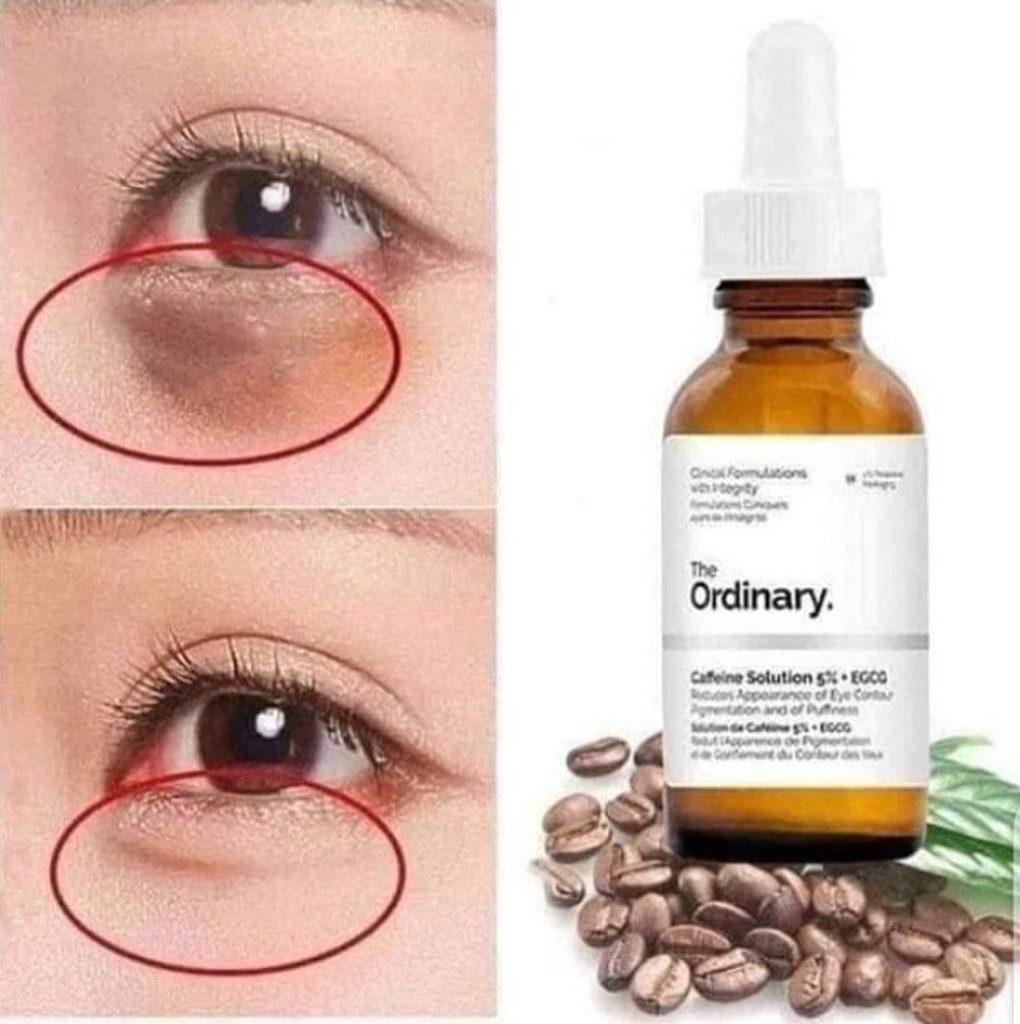 سرم دور چشم کافئین اوردینری