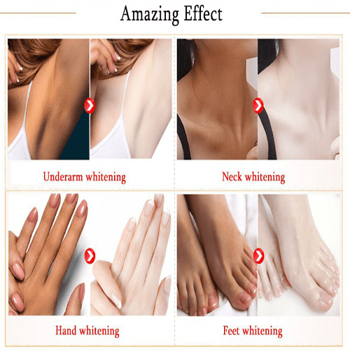 کرم کاسه ای سفید کننده بدن حاوی نیاسینامید و ویتامین سی سادور