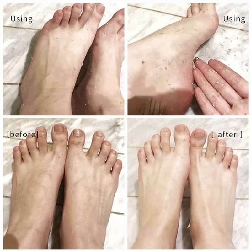 اسپری رفع ترک پا راکو (رایحه رندوم)