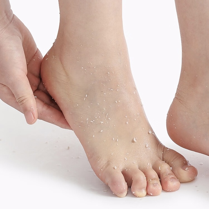 اسپری رفع ترک پا راکو (رایحه رندوم)