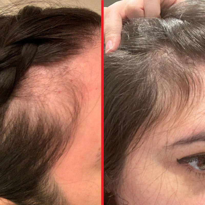 شامپو تقویت کننده و ضد ریزش مو بایواکوا رزماری