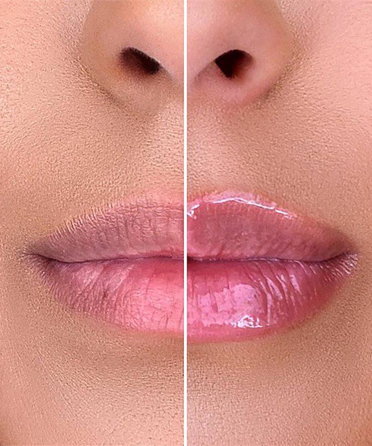 حجم دهنده ی لب کاریته