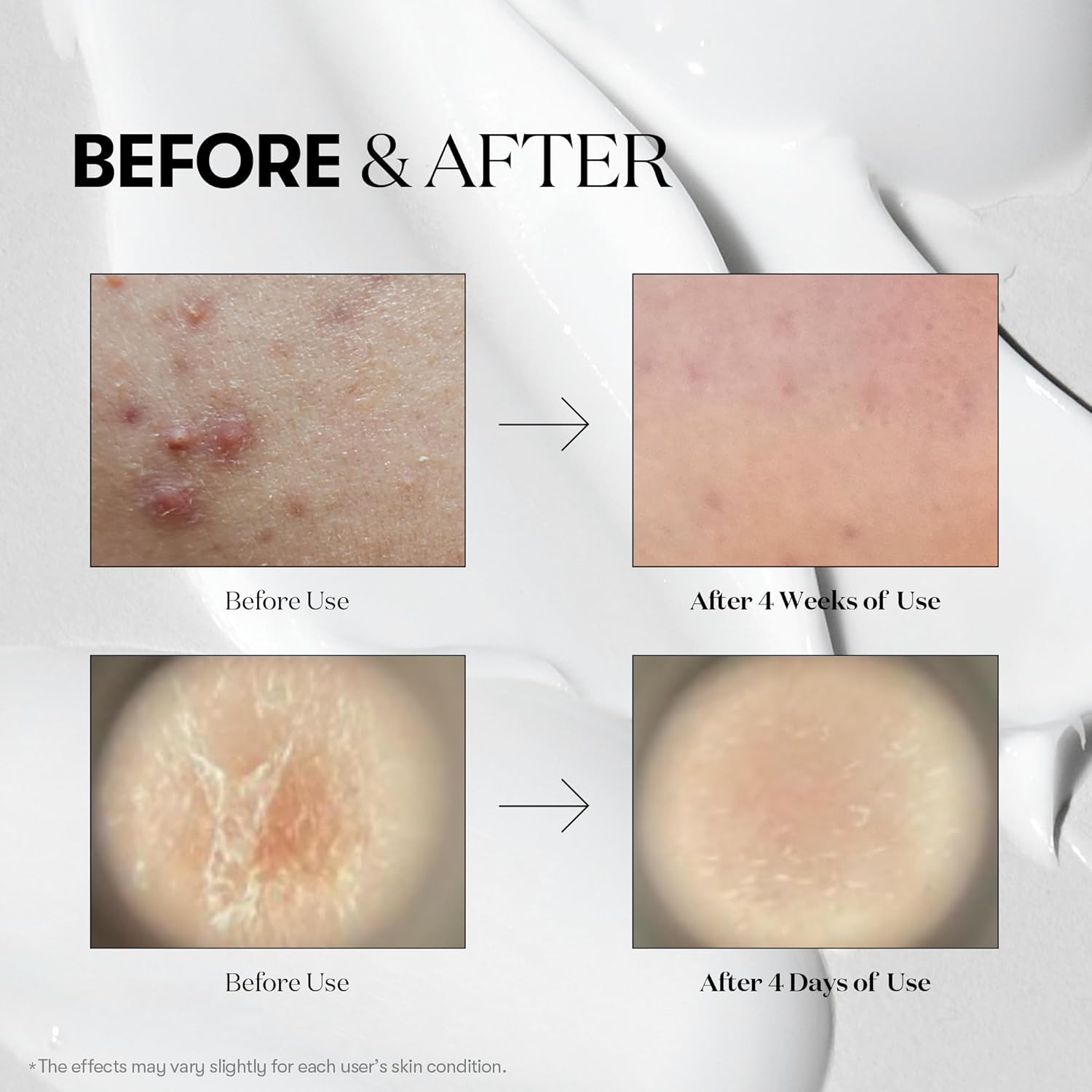 سرم میکرونیدلینگ ریدل شات Reedle Shot وی تی کازمتیکس Vt Cosmetics