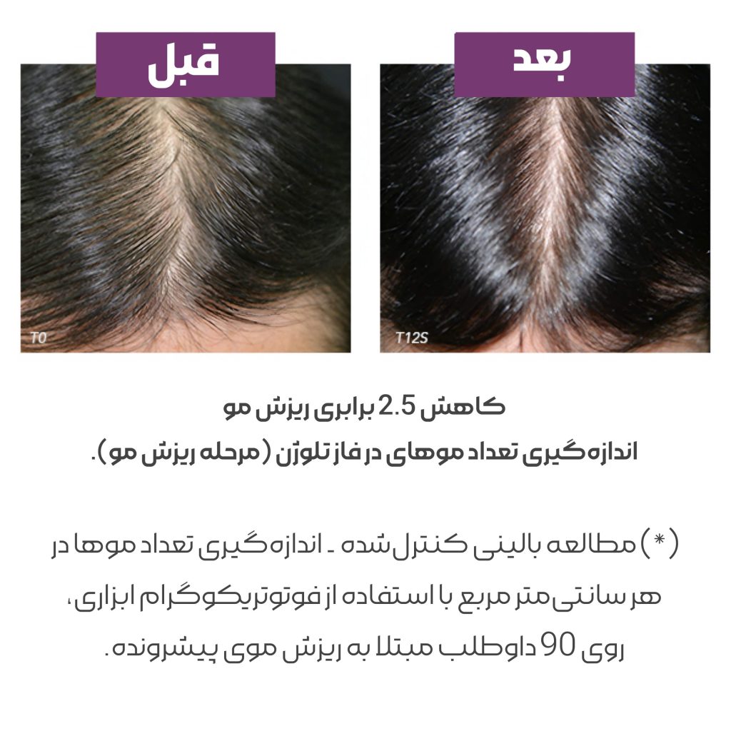 مکمل قرص کپسول ضد ریزش مو فیتو فیتوسیان جدید