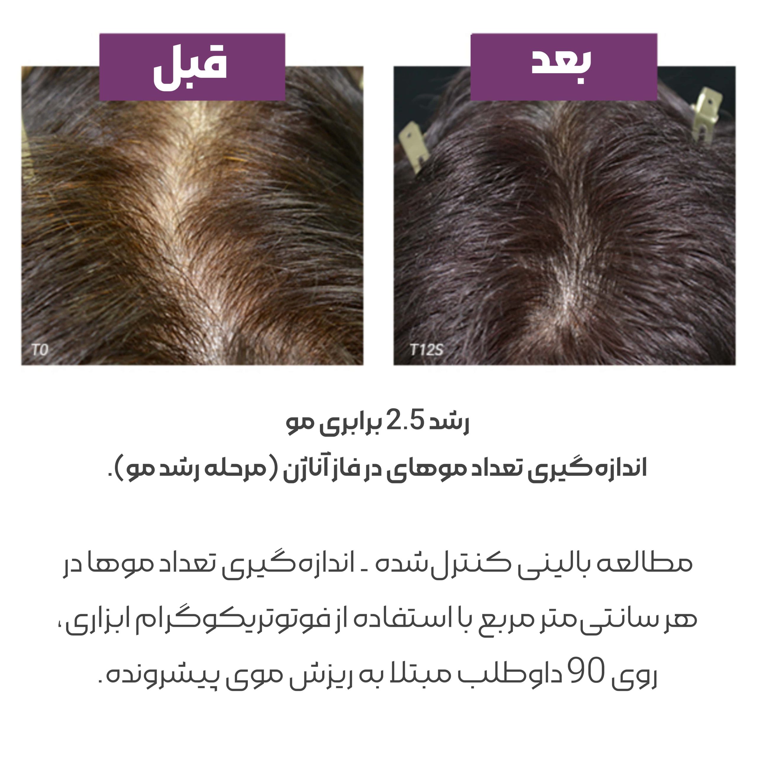 مکمل قرص کپسول ضد ریزش مو فیتو فیتوسیان جدید