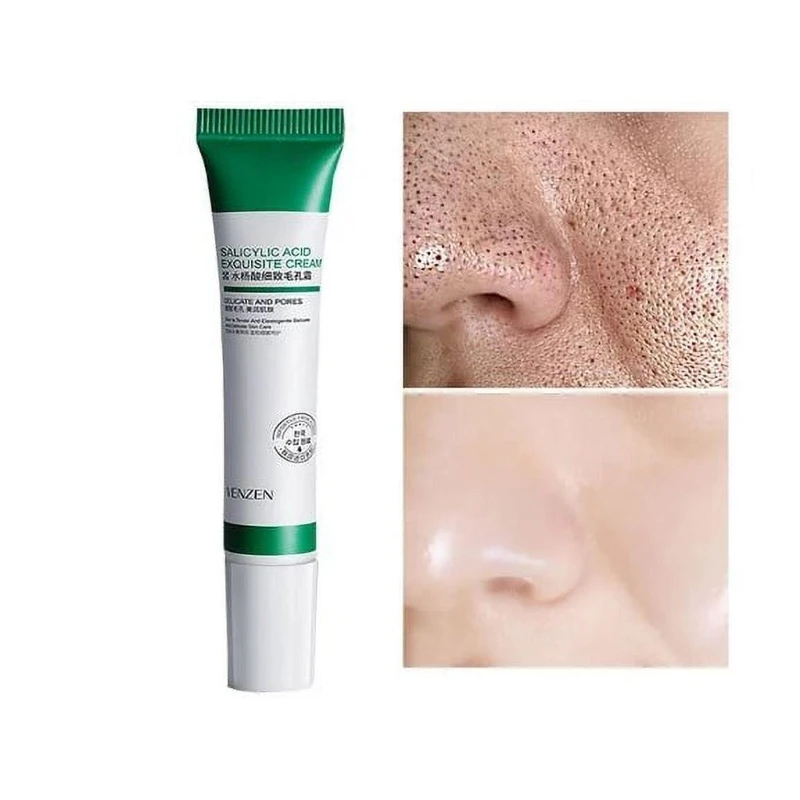 کرم ضد جوش وزه مدل سالیسیلیک اسید حجم 20 میلی لیتر