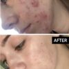 سرم آزلائیک اسید آنوا حجم 30 میل